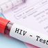 HIV: U Hrvatskoj se epidemija može u potpunosti spriječiti, ako se testira na vrijeme