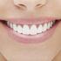 Načini kako izbijeliti zube na prirodni način